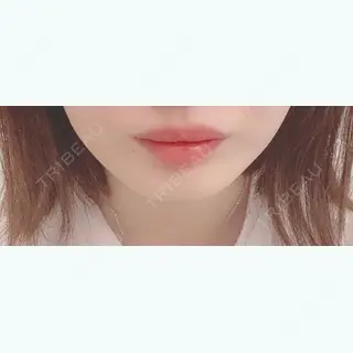50日目の経過画像（1枚目）