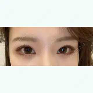 134日目の経過画像（1枚目）