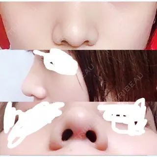 23日目の経過画像（1枚目）