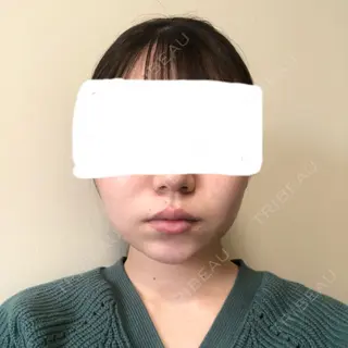 61日目の経過画像（1枚目）