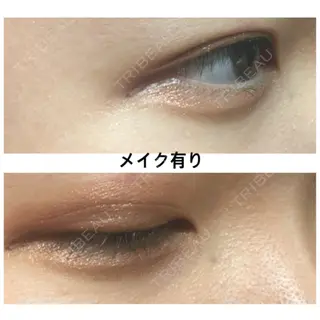 16日目の経過画像（2枚目）