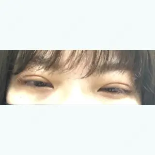 9日目の経過画像（3枚目）