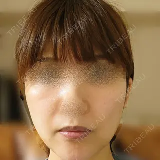 1日目の経過画像（1枚目）