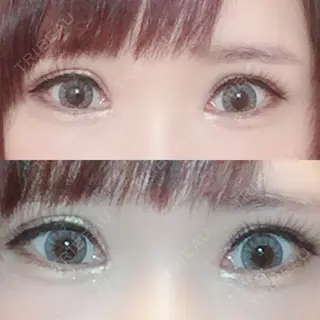 16日目の経過画像（1枚目）