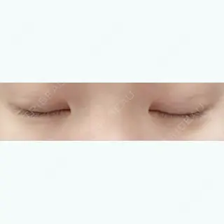 20日目の経過画像（2枚目）