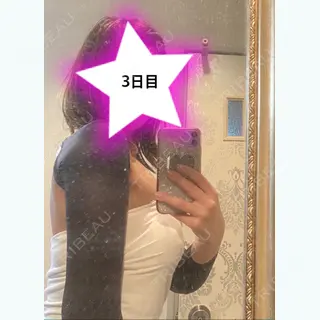 2日目の経過画像（1枚目）