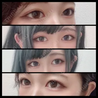97日目の経過画像（1枚目）