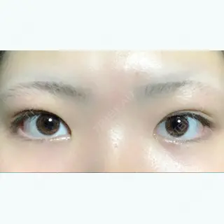 38日目の経過画像（1枚目）