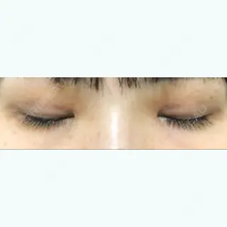 77日目の経過画像（3枚目）