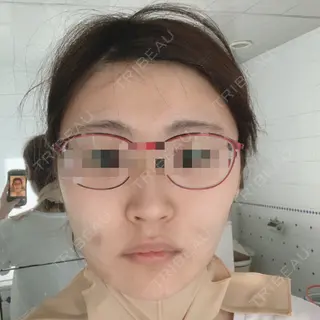 1日目の経過画像（1枚目）