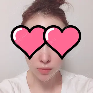 0日目の経過画像（1枚目）