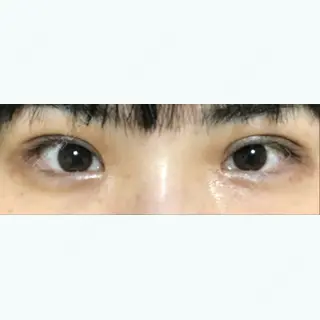 78日目の経過画像（1枚目）