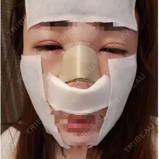 2日目の経過画像（1枚目）