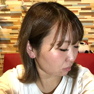 -28日目の経過画像（3枚目）