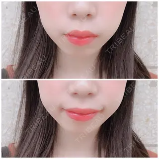 10日目の経過画像（1枚目）