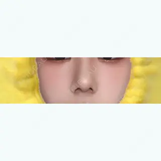 130日目の経過画像（1枚目）