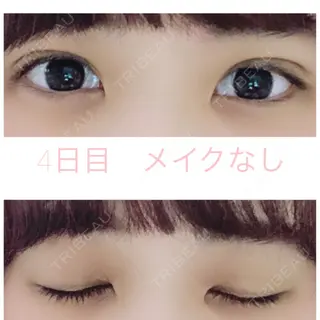 4日目の経過画像（1枚目）