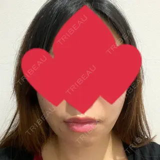 92日目の経過画像（1枚目）