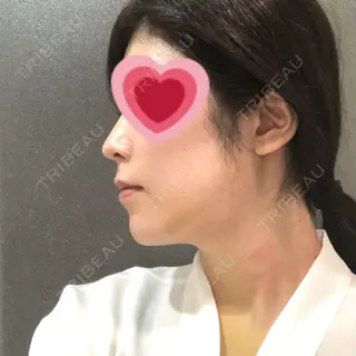7日目の経過画像（2枚目）