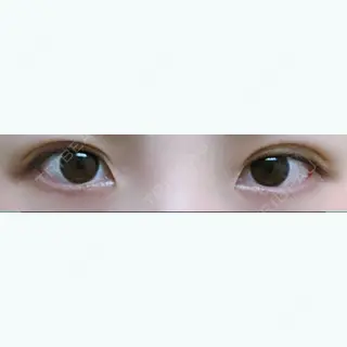 6日目の経過画像（1枚目）