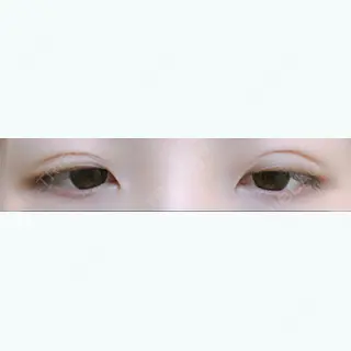7日目の経過画像（3枚目）