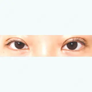 7日目の経過画像（1枚目）