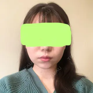 66日目の経過画像（1枚目）