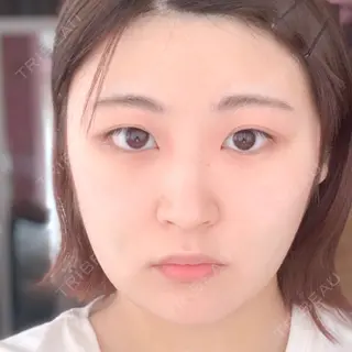 4日目の経過画像（1枚目）