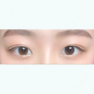 52日目の経過画像（1枚目）
