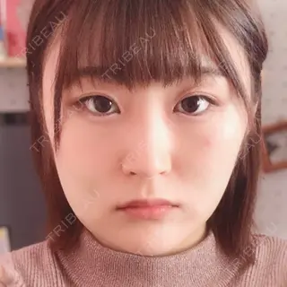 5日目の経過画像（1枚目）