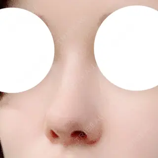 150日目の経過画像（2枚目）