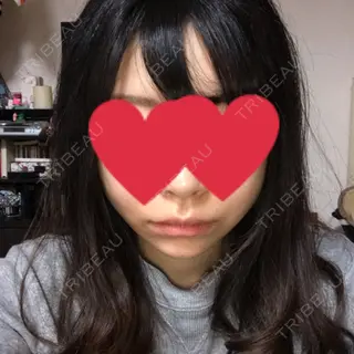 0日目の経過画像（3枚目）
