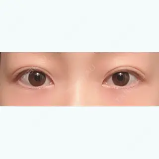 399日目の経過画像（1枚目）