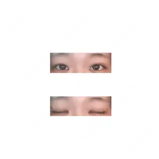 83日目の経過画像（1枚目）