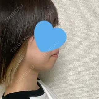 76日目の経過画像（1枚目）