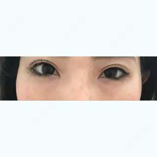 31日目の経過画像（1枚目）