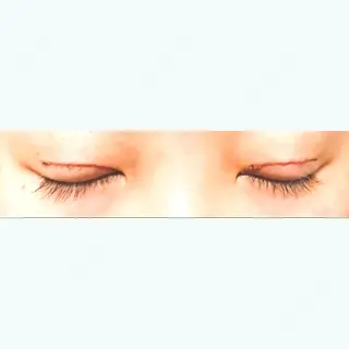 8日目の経過画像（2枚目）