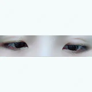 11日目の経過画像（3枚目）