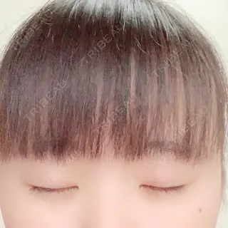 23日目の経過画像（2枚目）