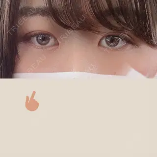25日目の経過画像（1枚目）
