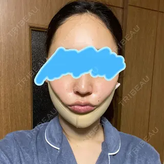 0日目の経過画像（1枚目）