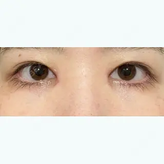 13日目の経過画像（1枚目）