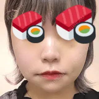 7日目の経過画像（2枚目）