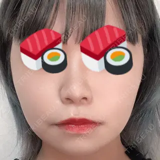 22日目の経過画像（2枚目）