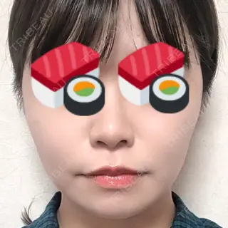 40日目の経過画像（2枚目）