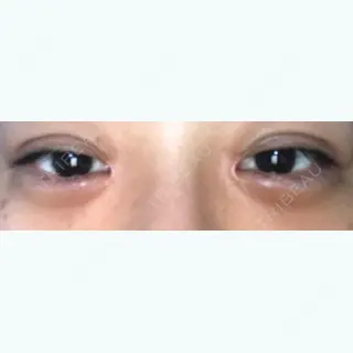 63日目の経過画像（1枚目）