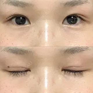 60日目の経過画像（1枚目）