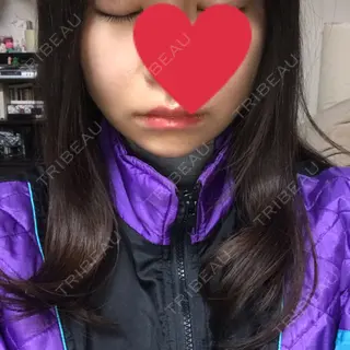 4日目の経過画像（1枚目）