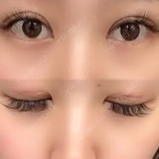 50日目の経過画像（1枚目）