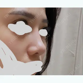124日目の経過画像（1枚目）